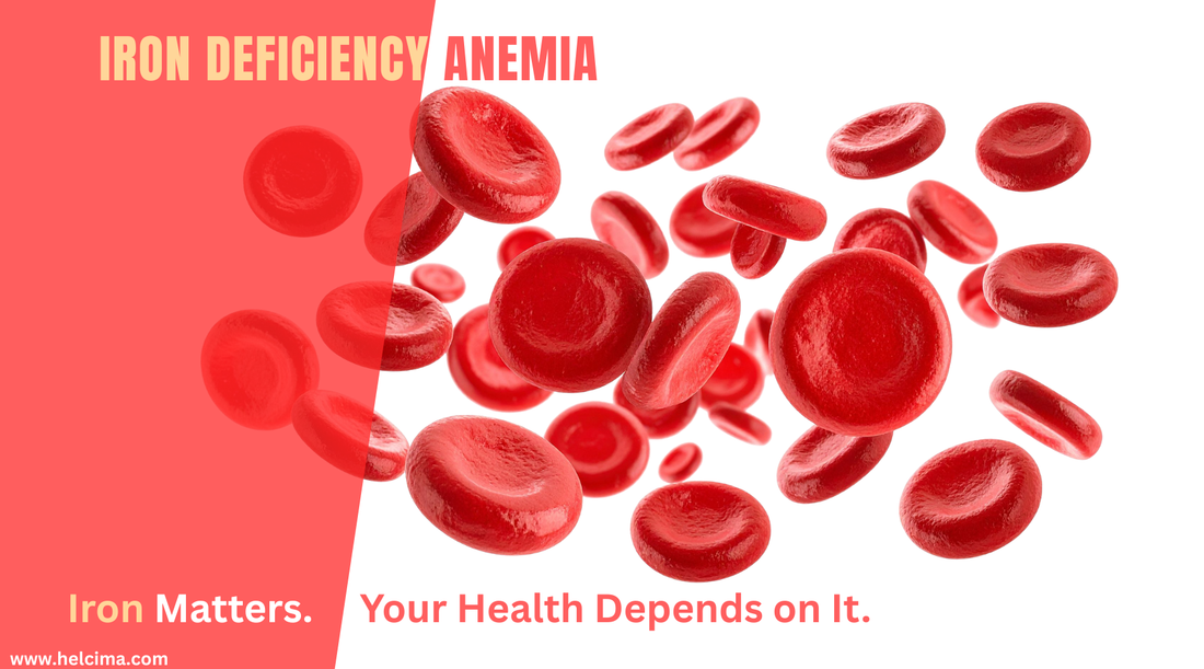 Iron Deficiency Anemia: The Hidden Burden Affecting Millions Worldwide